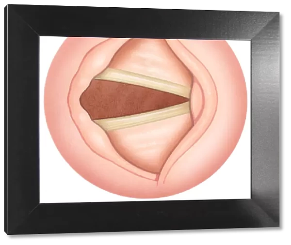 Illustration of open human vocal fold to inhale air, also known as vocal cords