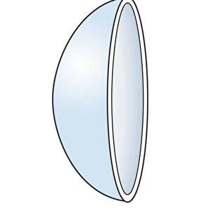 Illustration of soft contact lens