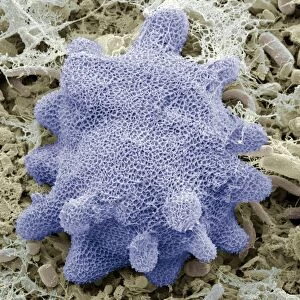 Korotnevella amoeba, SEM
