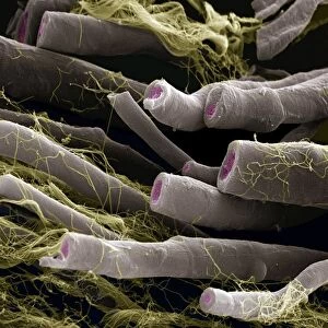 Myelinated nerve fibers