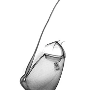Pitcher plant (Nepenthes x ventrata), X-ray