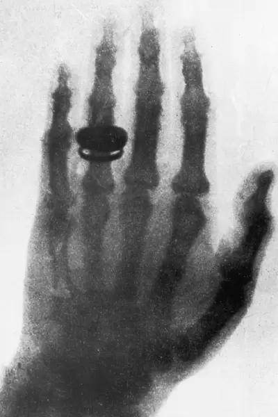 Early X-Ray
