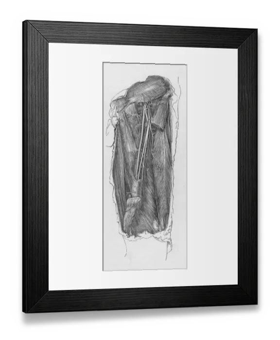 Framed Print : Arteria Femoralis
