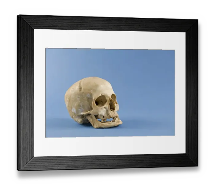 Framed Print : Human skull Framed Print : Human skull
