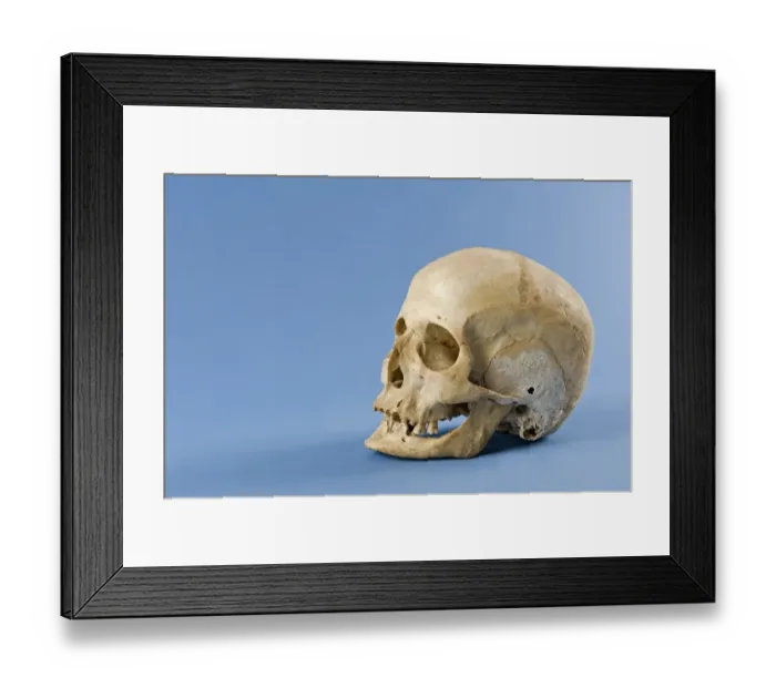Framed Print : Human skull Framed Print : Human skull