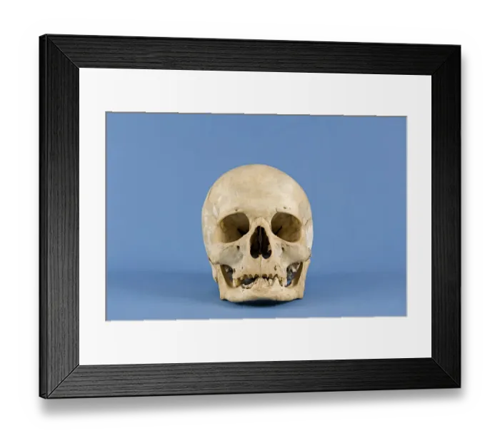 Framed Print : Human skull Framed Print : Human skull