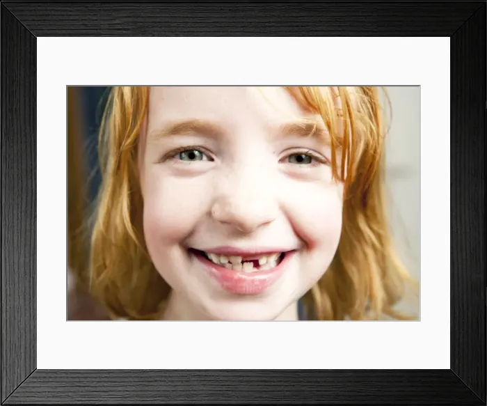 Framed Print : Portrait of a girl with red hair with a missing tooth Framed Print : Portrait of a girl with red hair with a missing tooth