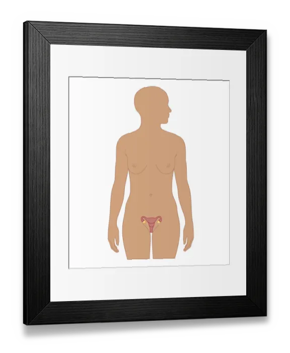 Framed Print : Cross section biomedical illustration of female reproductive organs Framed Print : Cross section biomedical illustration of female reproductive organs