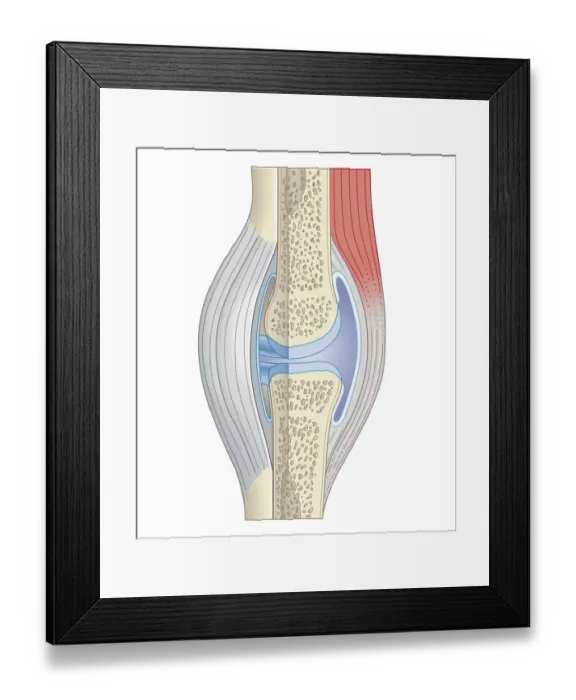Framed Print : Cross section biomedical illustration of synovial joint Framed Print : Cross section biomedical illustration of synovial joint