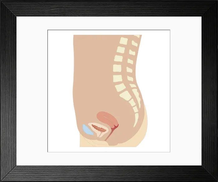 Framed Print : Cross section biomedical illustration of uterus, bladder and pubic bone in adult female