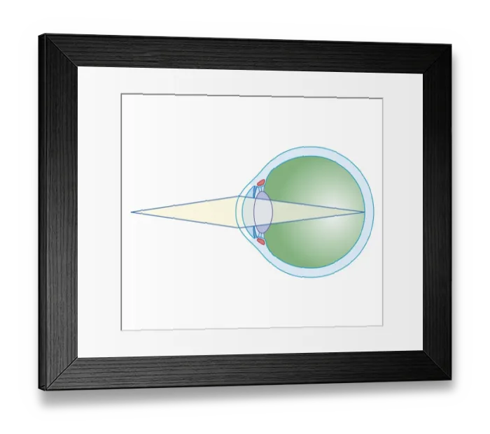 Framed Print : Cross section biomedical illustration of eye focusing on near object Framed Print : Cross section biomedical illustration of eye focusing on near object