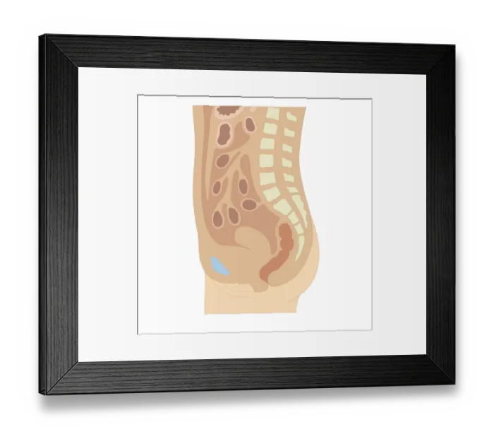 Framed Print : Cross section biomedical illustration of position of rectum and pubic bone in adult female Framed Print : Cross section biomedical illustration of position of rectum and pubic bone in adult female