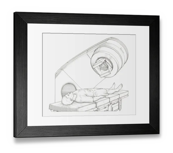 Framed Print : Black and white illustration of a patient undergoing radiation therapy Framed Print : Black and white illustration of a patient undergoing radiation therapy