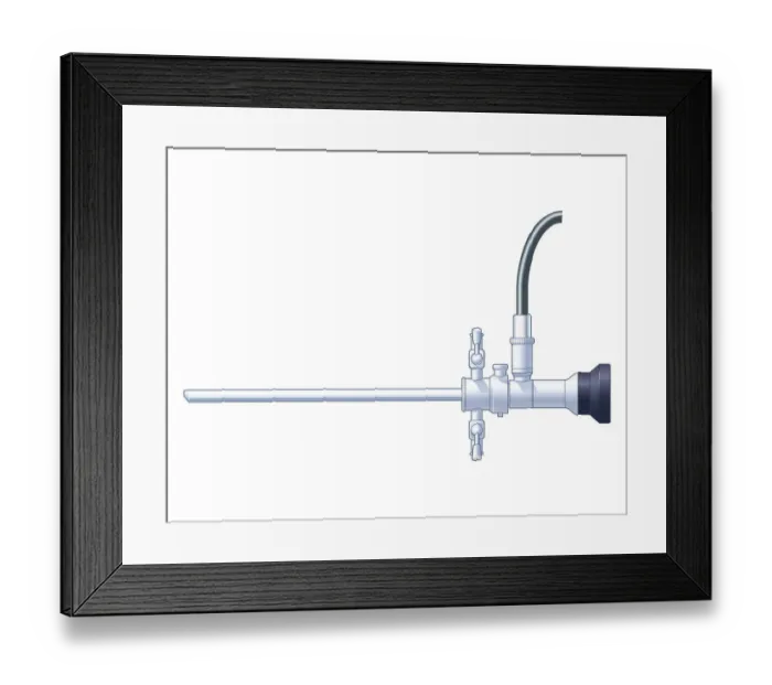 Framed Print : Biomedical illustration of rigid endoscope Framed Print : Biomedical illustration of rigid endoscope