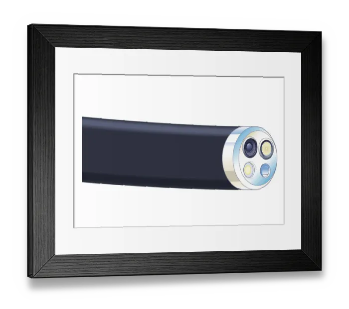 Framed Print : Biomedical illustration of tip of flexible endoscope Framed Print : Biomedical illustration of tip of flexible endoscope