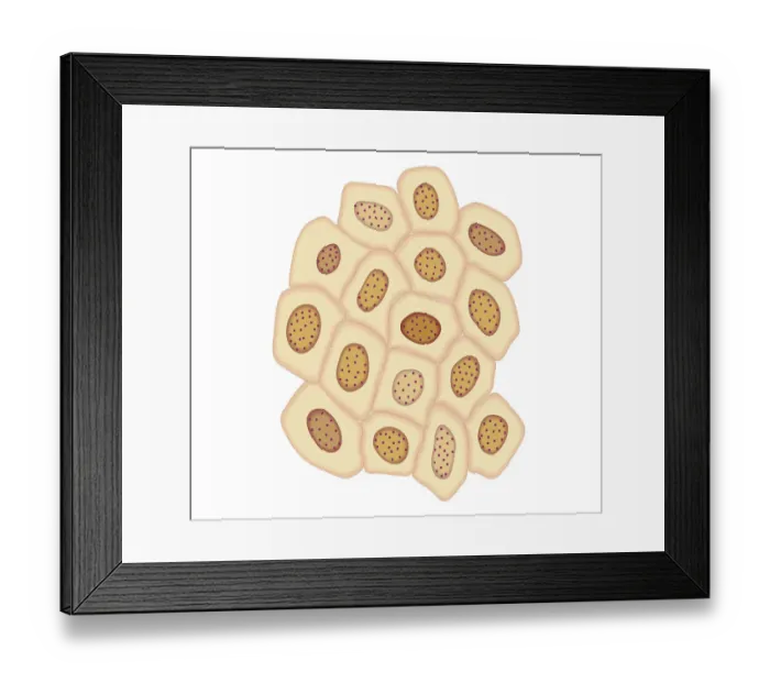 Framed Print : Cross section biomedical illustration of cancer cells forming tumour at fourth doubling stage Framed Print : Cross section biomedical illustration of cancer cells forming tumour at fourth doubling stage