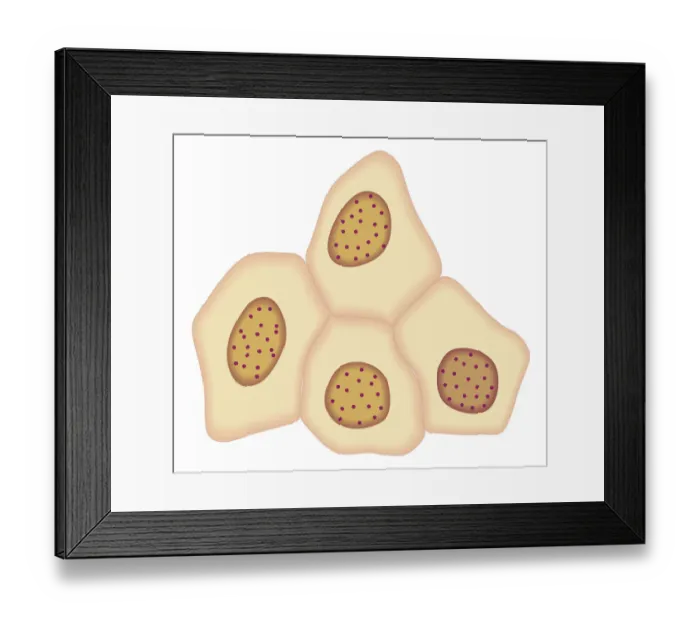 Framed Print : Cross section biomedical illustration of cancer cells forming tumour at second doubling stage Framed Print : Cross section biomedical illustration of cancer cells forming tumour at second doubling stage