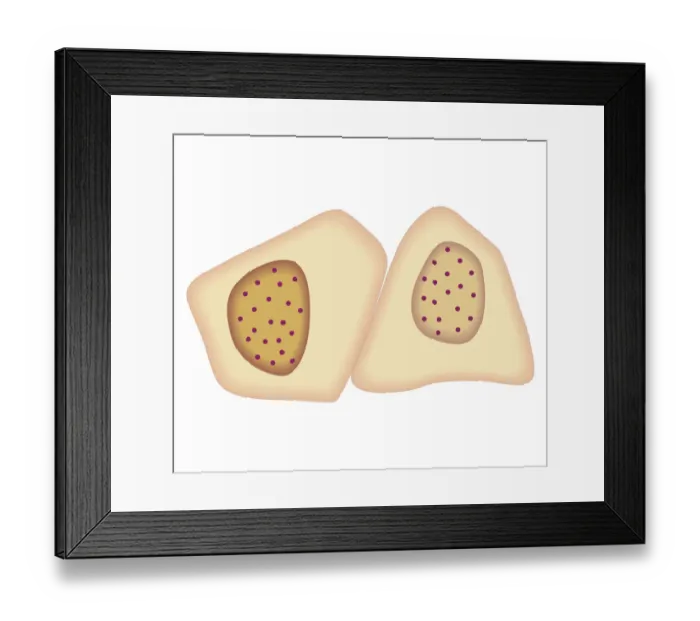 Framed Print : Cross section biomedical illustration of cancer cells forming tumour at first doubling stage