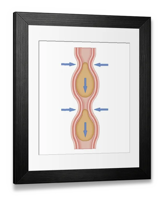 Framed Print : Cross section biomedical illustration of peristaltic wave Framed Print : Cross section biomedical illustration of peristaltic wave
