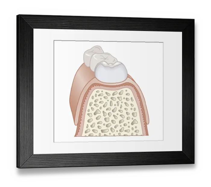 Framed Print : Cross section biomedical illustration of teeth, dentin, and bone, close-up Framed Print : Cross section biomedical illustration of teeth, dentin, and bone, close-up