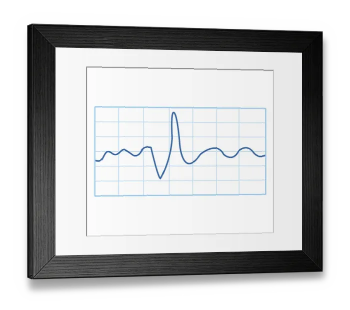 Framed Print : Biomedical illustration of electromyography (EMG) result Framed Print : Biomedical illustration of electromyography (EMG) result