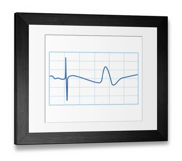 Framed Print : Biomedical illustration of nerve conduction trace Framed Print : Biomedical illustration of nerve conduction trace