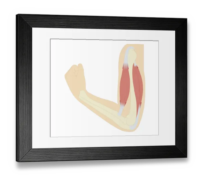 Framed Print : Cross section biomedical illustration of location of muscle proprioceptors in male arm Framed Print : Cross section biomedical illustration of location of muscle proprioceptors in male arm