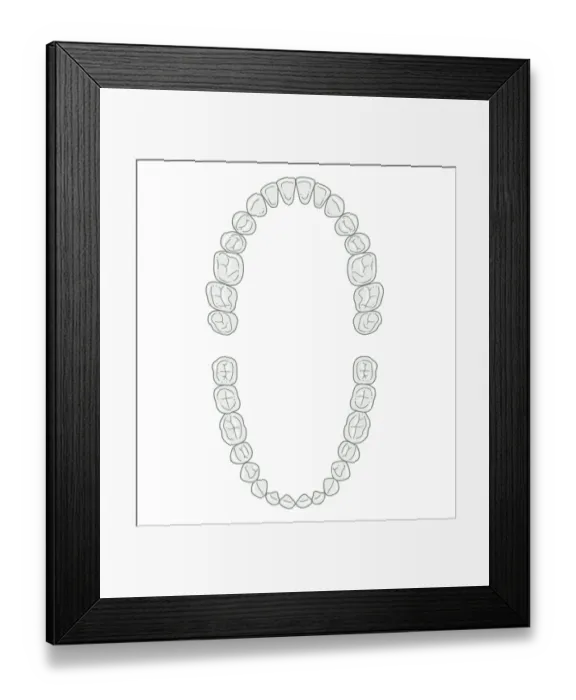 Framed Print : Black and white illustration of secondary teeth Framed Print : Black and white illustration of secondary teeth