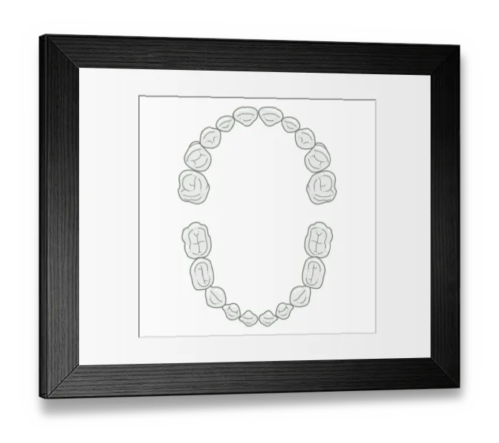 Framed Print : Black and white illustration of primary teeth Framed Print : Black and white illustration of primary teeth