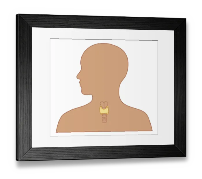 Framed Print : Cross section biomedical illustration of position of thyroid and parathyroid glands in person Framed Print : Cross section biomedical illustration of position of thyroid and parathyroid glands in person