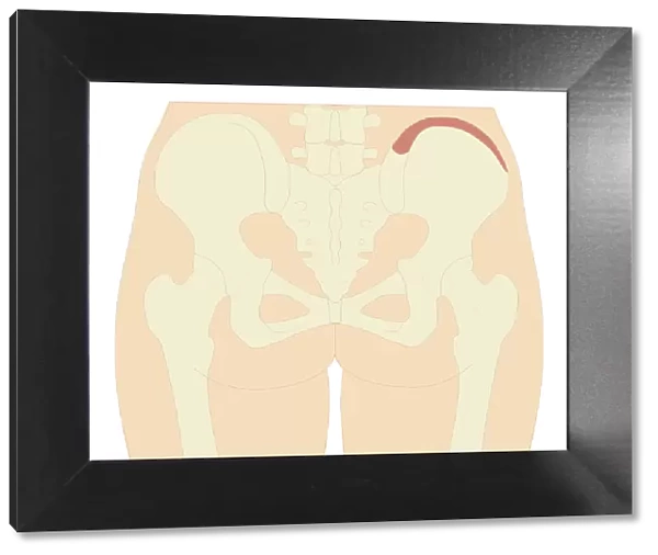 Cross section biomedical illustration of iliac crest site on pelvis