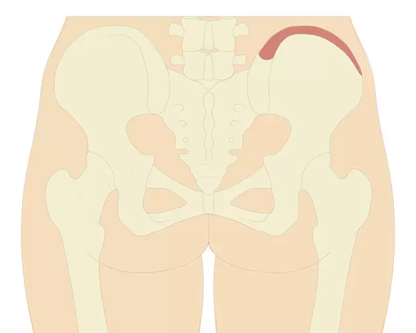 Cross section biomedical illustration of iliac crest site on pelvis