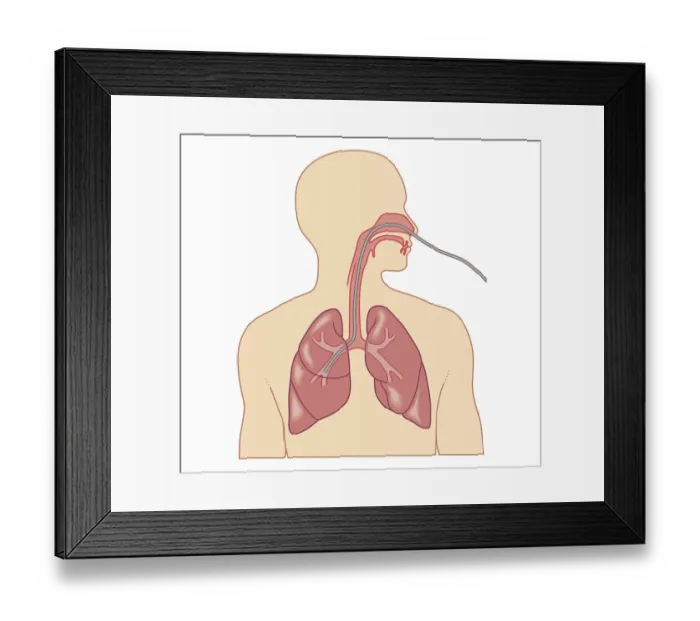 Framed Print : Cross section biomedical illustration of route of bronchoscope inserted through nose Framed Print : Cross section biomedical illustration of route of bronchoscope inserted through nose