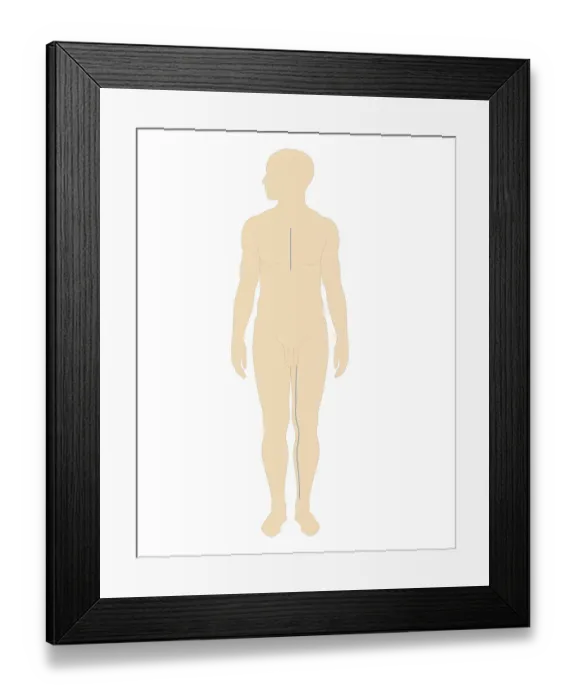 Framed Print : Cross section biomedical illustration of incision sites in chest and leg for saphenous vein bypass graft in adult male