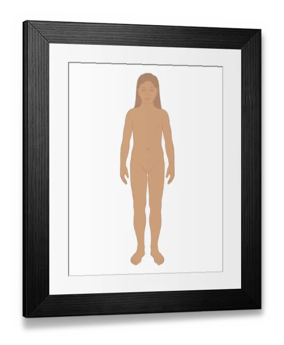 Framed Print : Biomedical illustration of girl before puberty