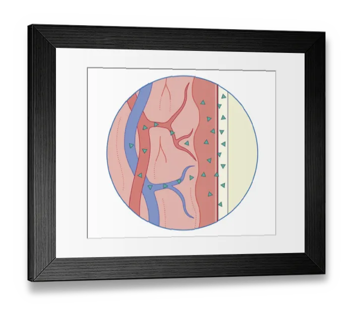 Framed Print : Cross section biomedical illustration of drug inserted into rectum absorbed by blood vessels in rectal wall Framed Print : Cross section biomedical illustration of drug inserted into rectum absorbed by blood vessels in rectal wall