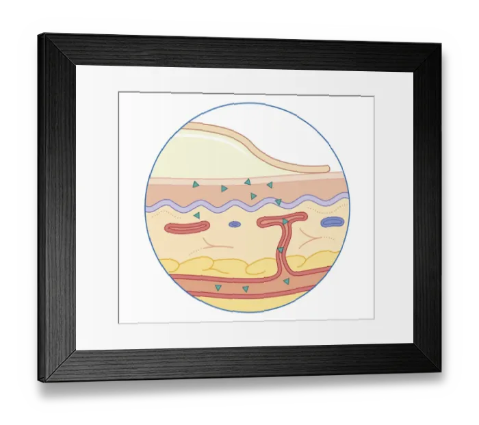 Framed Print : Cross section biomedical illustration of drug are released continuously from adhesive patch or gel on surface of skin surface passing through into blood vessel Framed Print : Cross section biomedical illustration of drug are released continuously from adhesive patch or gel on surface of skin surface passing through into blood vessel