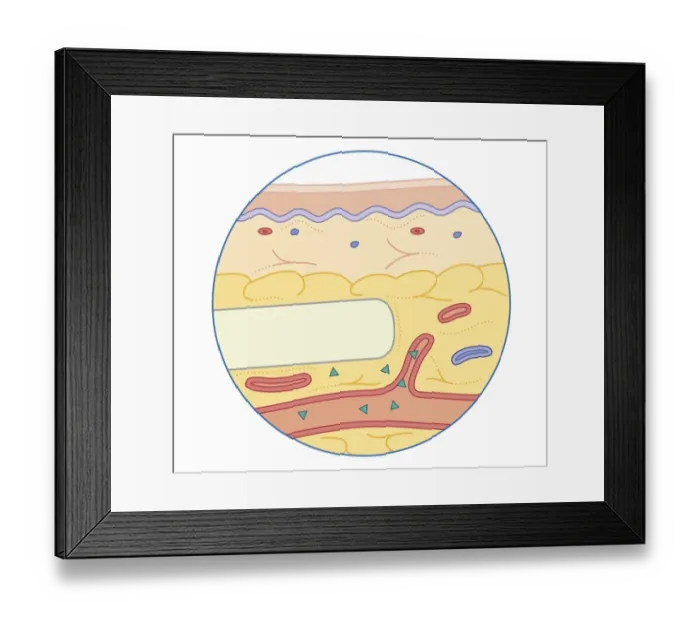 Framed Print : Cross section biomedical illustration of subcutaneous drug implanted or into fatty tissue just below the skin dispersing slowly into bloodstream Framed Print : Cross section biomedical illustration of subcutaneous drug implanted or into fatty tissue just below the skin dispersing slowly into bloodstream
