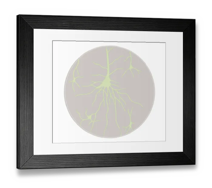 Framed Print : Biomedical illustration of neural network at birth Framed Print : Biomedical illustration of neural network at birth