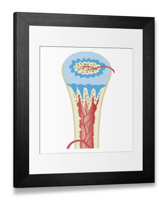 Framed Print : Cross section biomedical illustration of childhood development long bone Framed Print : Cross section biomedical illustration of childhood development long bone