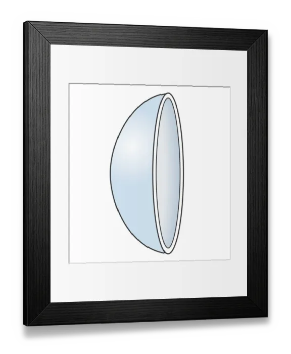 Framed Print : Illustration of soft contact lens Framed Print : Illustration of soft contact lens