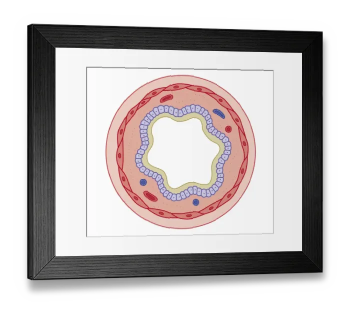 Framed Print : Cross section biomedical illustration of how bronchodilator drugs work after ingesting the drug the muscles relax and the airway widens, increasing air flow Framed Print : Cross section biomedical illustration of how bronchodilator drugs work after ingesting the drug the muscles relax and the airway widens, increasing air flow