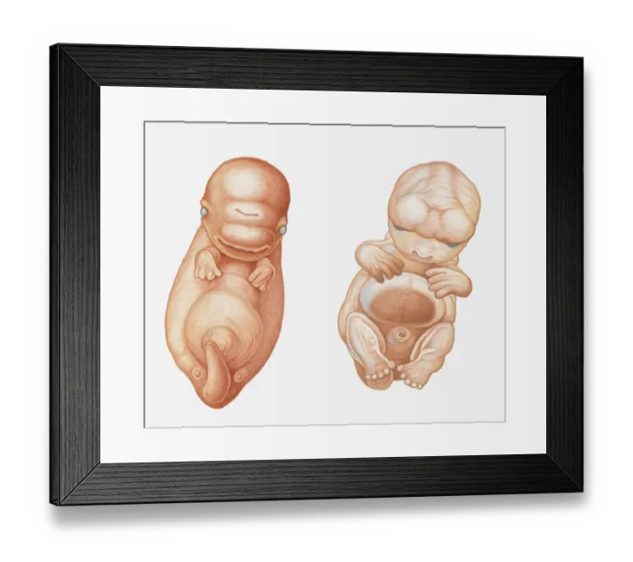 Framed Print : Illustration of Pacific White-sided Dolphin (Lagenorhynchus obliquidens) embryo at seven weeks, and human embryo (Homo sapiens) at seven weeks