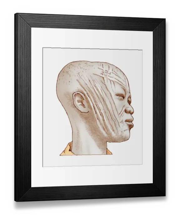 Framed Print : Illustration of African womans head showing scarring Framed Print : Illustration of African womans head showing scarring