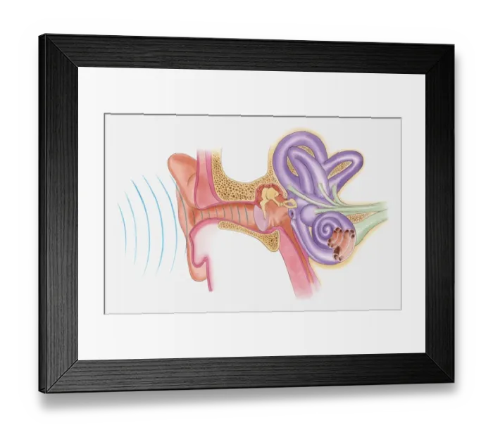 Framed Print : Anatomical illustration of sound vibrations entering ear Framed Print : Anatomical illustration of sound vibrations entering ear