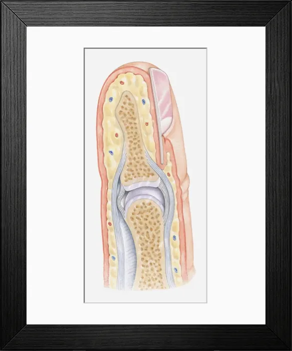 Framed Print : Cross section illustration of human finger Framed Print : Cross section illustration of human finger