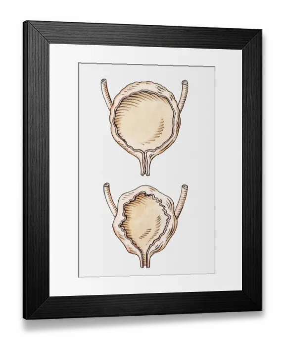 Framed Print : Illustration of full and empty human bladder Framed Print : Illustration of full and empty human bladder
