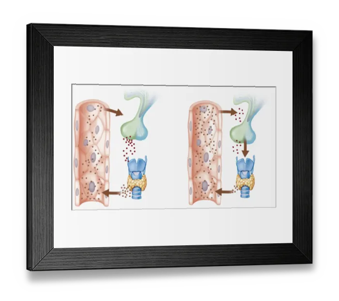 Framed Print : Digital cross section illustration of hypothalamus triggering chain reaction of reduced hormone production resulting in falling glucose levels Framed Print : Digital cross section illustration of hypothalamus triggering chain reaction of reduced hormone production resulting in falling glucose levels