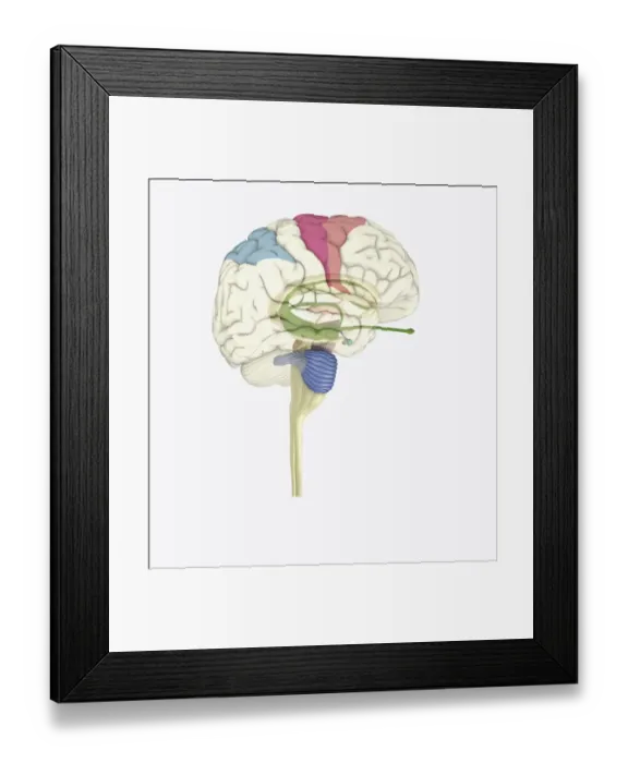 Framed Print : Digital illustration of highlighted areas in human brain affected by motor disorders Framed Print : Digital illustration of highlighted areas in human brain affected by motor disorders