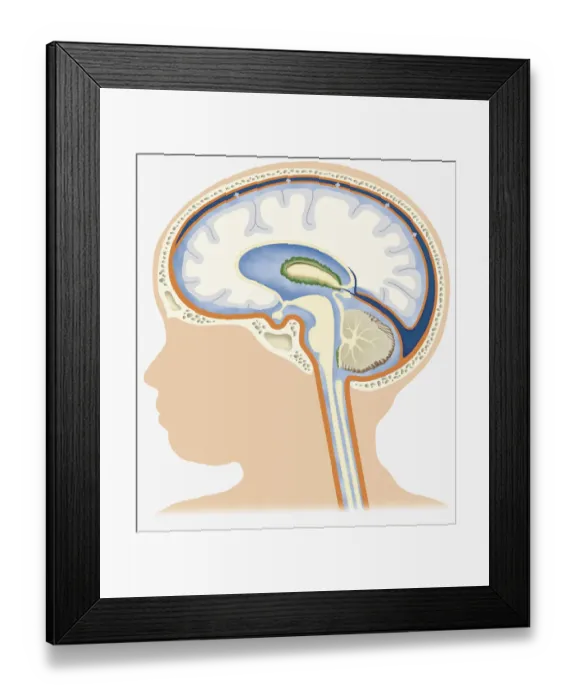 Framed Print : Digital illustration of head in profile showing cerebrospinal fluid on brain of baby Framed Print : Digital illustration of head in profile showing cerebrospinal fluid on brain of baby